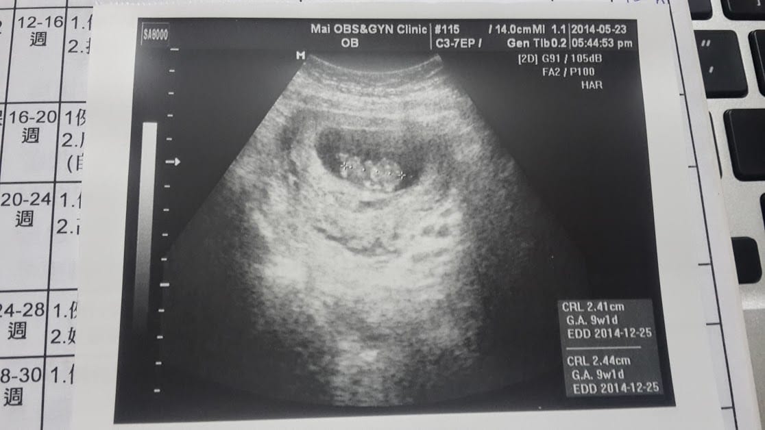 有小三的這些日子以來～。9w。第一次產檢報告