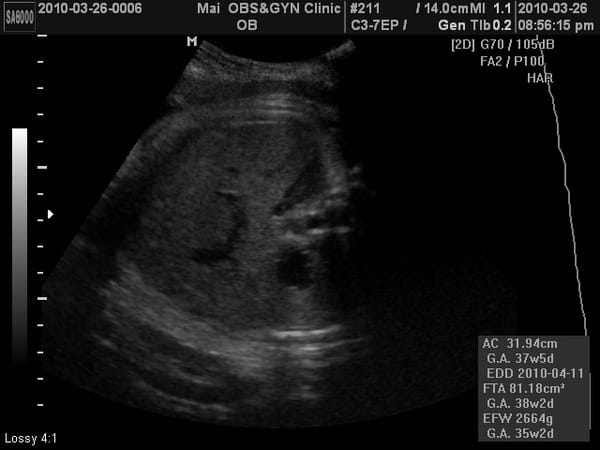 2010-3-26 (第九次產檢) (4).JPG