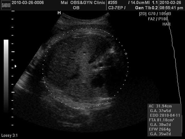 2010-3-26 (第九次產檢) (3).JPG