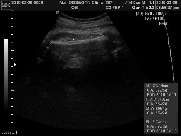 2010-3-26 (第九次產檢) (5).JPG