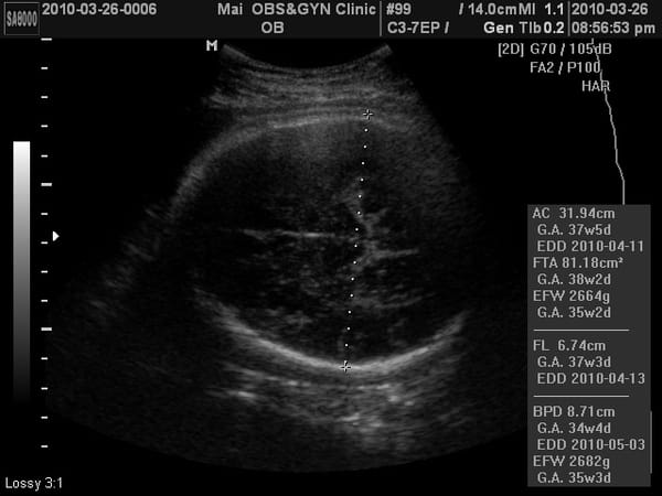 2010-3-26 (第九次產檢) (6).JPG