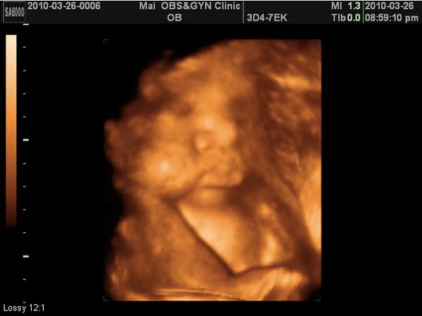 2010-3-26 (第九次產檢) (7).JPG