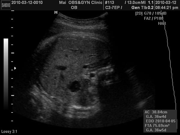 2010-3-12(第八次產檢) (3).JPG