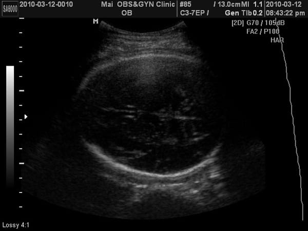 2010-3-12(第八次產檢) (2).JPG