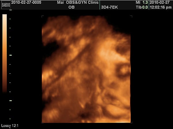 2010-2-27(第七次產檢) (4).JPG