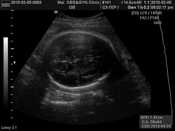 BABY2010-2-5_1.JPG