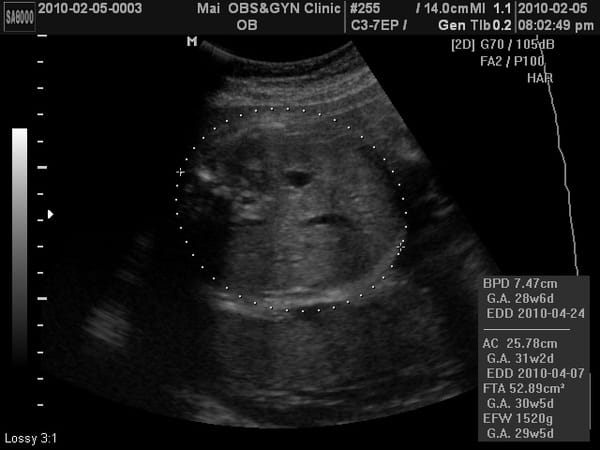 BABY2010-2-5_2.JPG