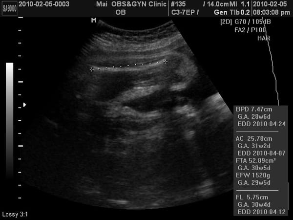 BABY2010-2-5_3.JPG